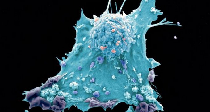 Descubiertas unas ‘células escudo’ que protegen los tumores