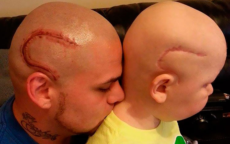 Se tatuó la cicatriz de su hijo con cáncer, para darle confianza y fuerza para seguir luchando