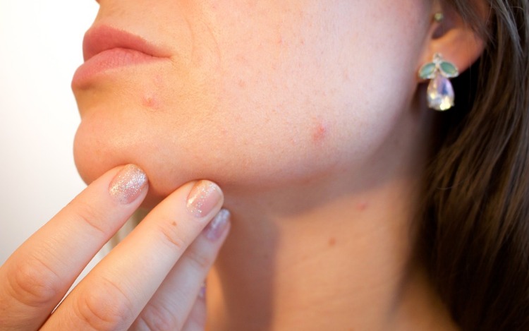 Manchas marrones en la piel: 5 hábitos poco saludables que las provocan y cómo hacer para tratarlas