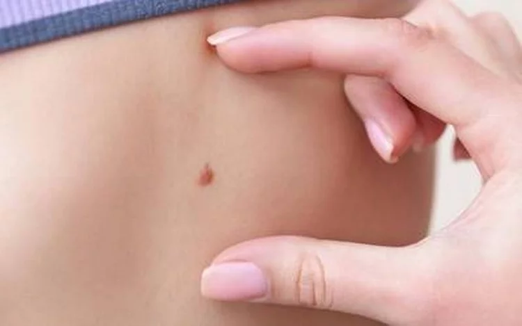 También te puede interesar esta nota... Cuidar nuestra piel durante todo el año, una acción indispensable para prevenir el cáncer de piel